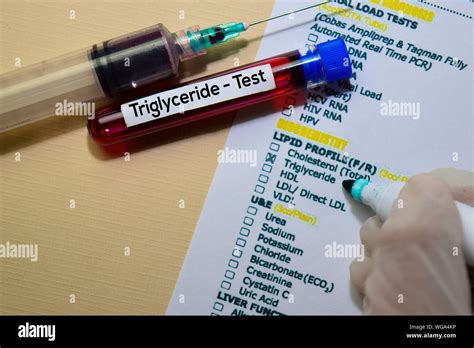 triglyceride test from drop of blood|what blood test checks triglycerides.